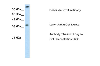 TST Rabbit Polyclonal Antibody
