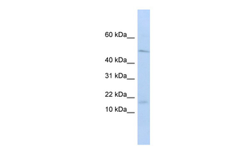 VPREB1 Rabbit Polyclonal Antibody