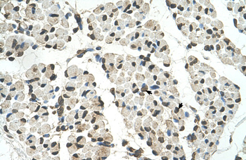 PSD3 Rabbit Polyclonal Antibody