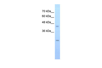 FLJ20489 Rabbit Polyclonal Antibody