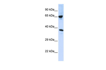 C6orf134 Rabbit Polyclonal Antibody
