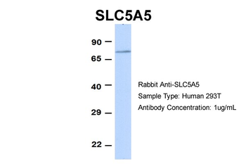 SLC5A5 Rabbit Polyclonal Antibody