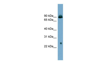 SLC6A5 Rabbit Polyclonal Antibody