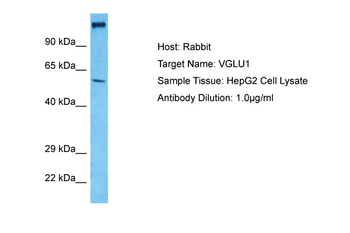 SLC17A7 Rabbit Polyclonal Antibody