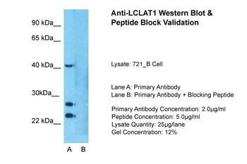 LYCAT Rabbit Polyclonal Antibody