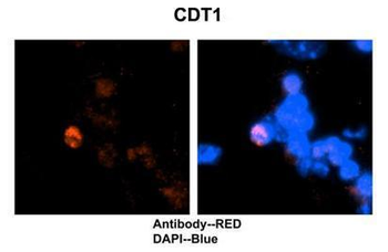 CDT1 Rabbit Polyclonal Antibody