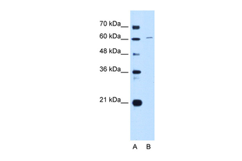 CDT1 Rabbit Polyclonal Antibody