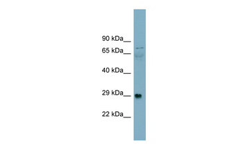 DAG1 Rabbit Polyclonal Antibody