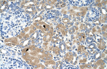 LMAN2 Rabbit Polyclonal Antibody