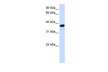 ICMT Rabbit Polyclonal Antibody
