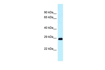 Dram1 Rabbit Polyclonal Antibody