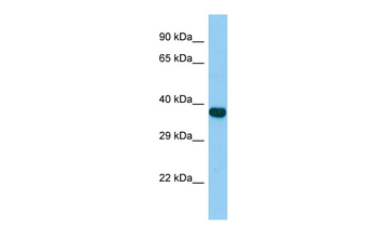 Zfp367 Rabbit Polyclonal Antibody