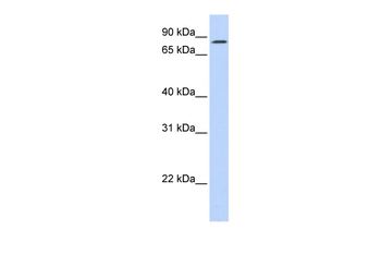 KIZ Rabbit Polyclonal Antibody