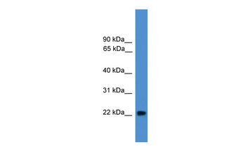 NUDT16L1 Rabbit Polyclonal Antibody