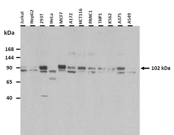 FAM62B Rabbit Polyclonal Antibody