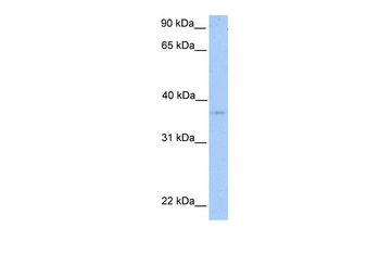 NPAL2 Rabbit Polyclonal Antibody
