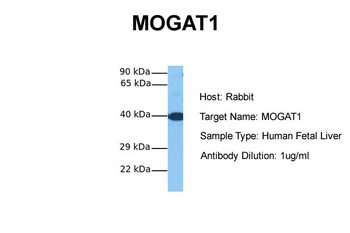 MOGAT1 Rabbit Polyclonal Antibody