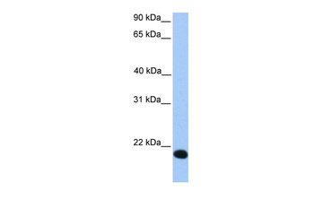 ZNF833P Rabbit Polyclonal Antibody