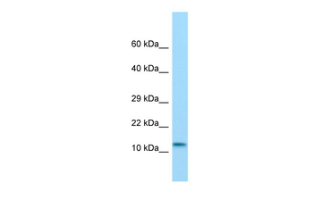 MRTFB Rabbit Polyclonal Antibody