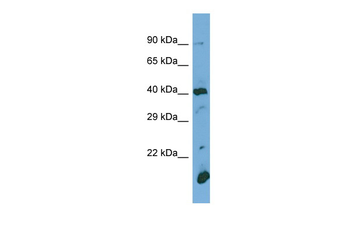 POGLUT1 Rabbit Polyclonal Antibody