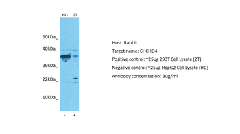 CHCHD4 Rabbit Polyclonal Antibody