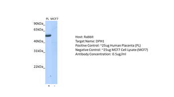 DPH1 Rabbit Polyclonal Antibody