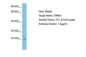 CRYBA1 Rabbit Polyclonal Antibody