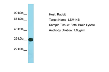 LSM14B Rabbit Polyclonal Antibody