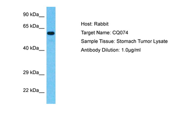 SPEM2 Rabbit Polyclonal Antibody