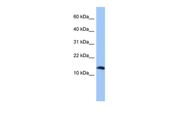 PTH2 Rabbit Polyclonal Antibody