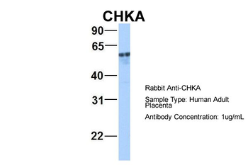CHKA Rabbit Polyclonal Antibody