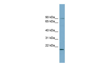 KIAA0776 Rabbit Polyclonal Antibody