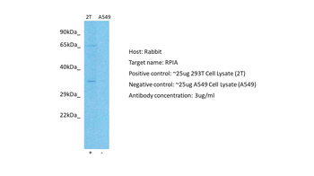 RPIA Rabbit Polyclonal Antibody