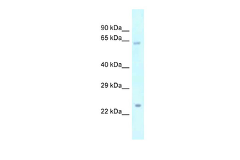 CATIP Rabbit Polyclonal Antibody