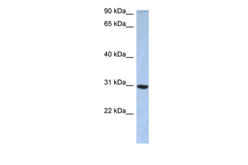 C16orf65 Rabbit Polyclonal Antibody