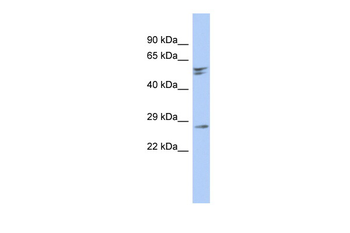 RD3 Rabbit Polyclonal Antibody