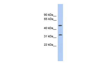 FAM79B Rabbit Polyclonal Antibody