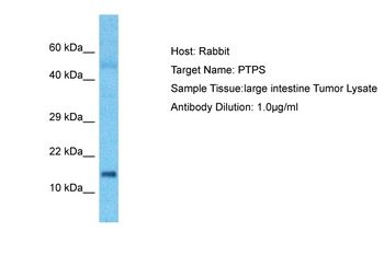 PTS Rabbit Polyclonal Antibody