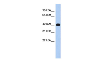 KIAA1189 Rabbit Polyclonal Antibody