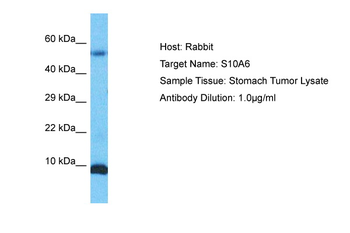 S100A6 Rabbit Polyclonal Antibody