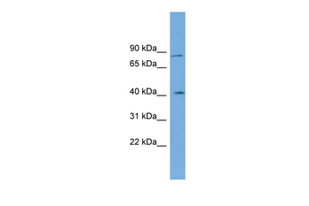 CPXM1 Rabbit Polyclonal Antibody