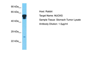 NUCKS1 Rabbit Polyclonal Antibody