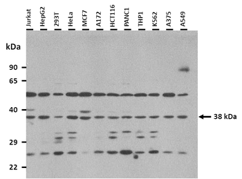 RP11-217H1.1 Rabbit Polyclonal Antibody