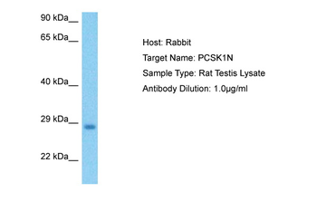Pcsk1n Rabbit Polyclonal Antibody