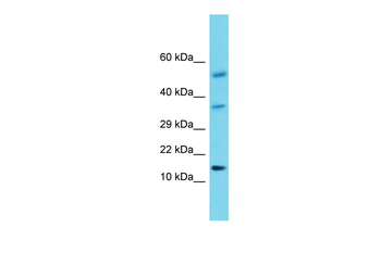 HCRT Rabbit Polyclonal Antibody