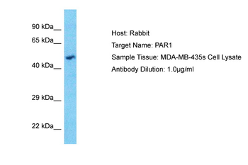 F2R Rabbit Polyclonal Antibody