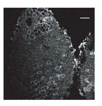 CALB1 Rabbit Polyclonal Antibody