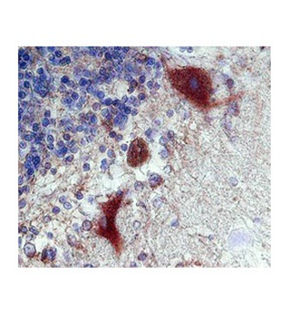 CALB1 Rabbit Polyclonal Antibody