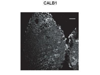 CALB1 Rabbit Polyclonal Antibody