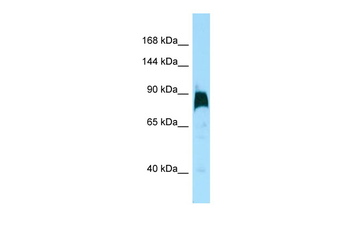 KIF7 Rabbit Polyclonal Antibody